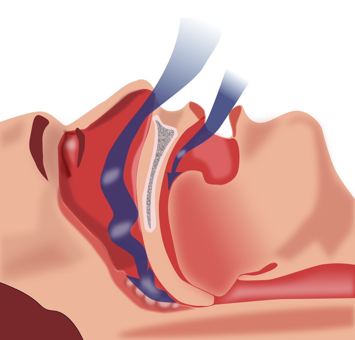 What The Diary of a CEO Got Right About Sleep Apnea
