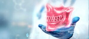 TMJ Treatment In Northern California