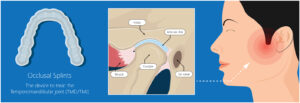 Understanding the Impact of Untreated TMD on Your Life