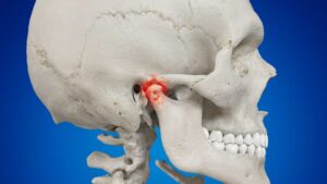 If you suspect that you have TMD